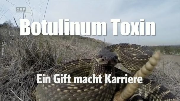 Botulinum Toxin - Ein Gift macht Karriere