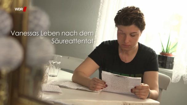 Wenn aus Liebe Hass wird - Vanessas Leben nach dem Säureattentat